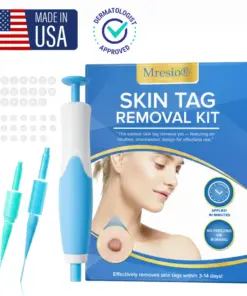 Mresio® Skin Tag Removal Kit