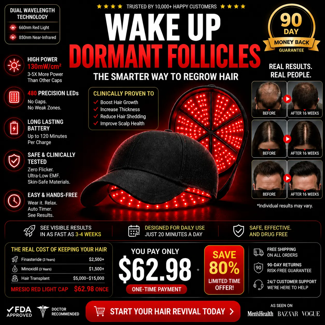 Mresio® Red Light Cap — Regrow Hair, Reduce Shedding