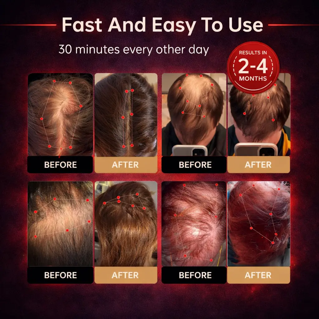 Mresio® Red Light Cap — Regrow Hair, Reduce Shedding