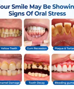 Mresio® RegenDent Advanced Tooth & Gum Renewal Device