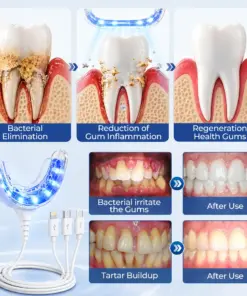 Mresio® RegenDent Advanced Tooth & Gum Renewal Device