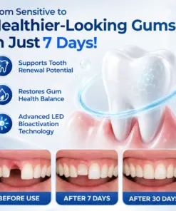 Mresio® RegenDent Advanced Tooth & Gum Renewal Device