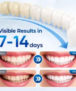Mresio® RegenDent Advanced Tooth & Gum Renewal Device
